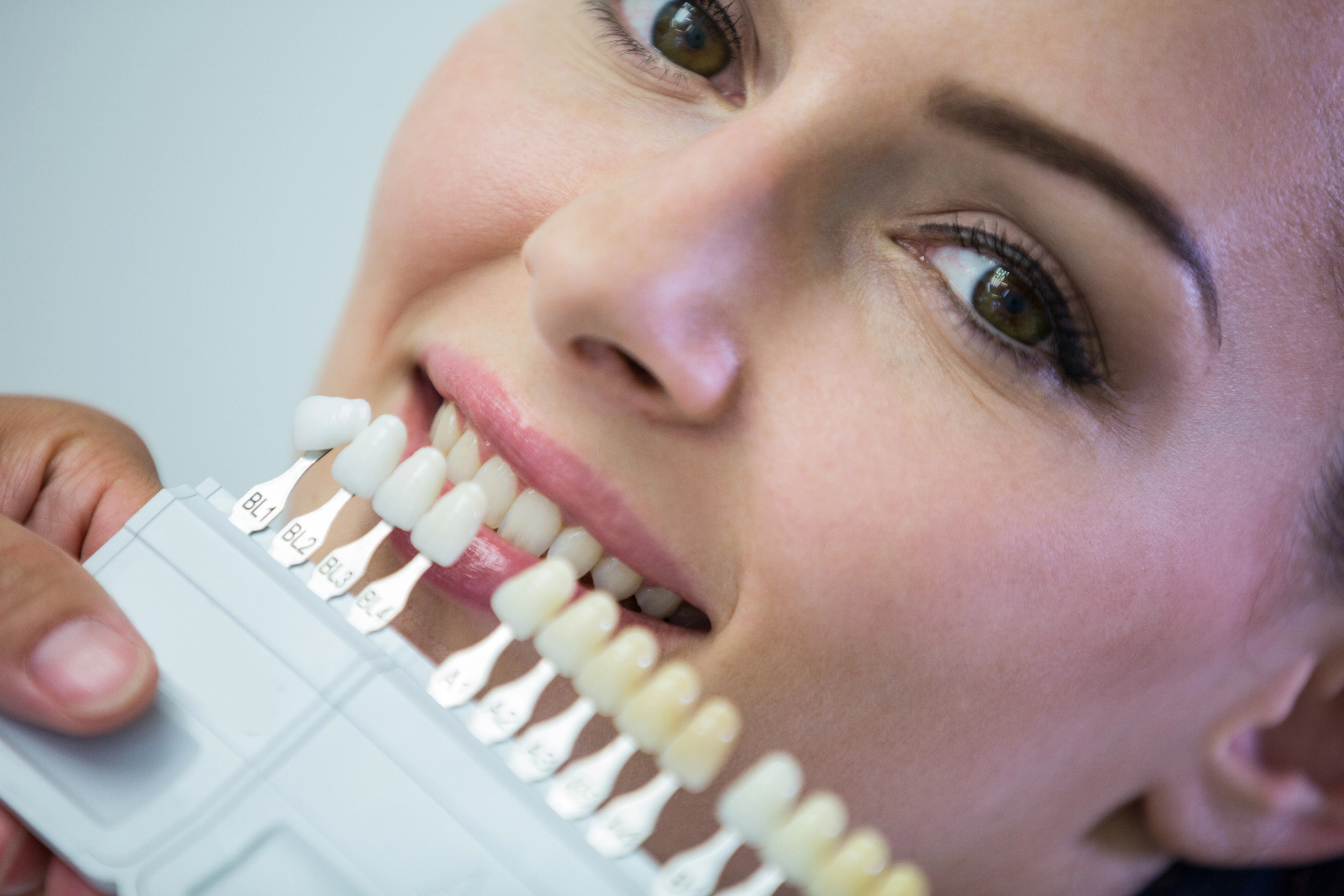 Determining teeth color for teeth whitening procedure