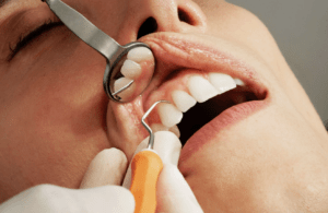dental checkup
