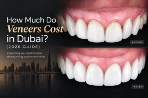 How much do veneers cost in dubai?